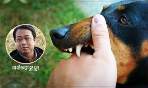 विज्ञका कुरा – जनावरको टोकाईलाई ख्यालठट्टा नसम्झौँ…