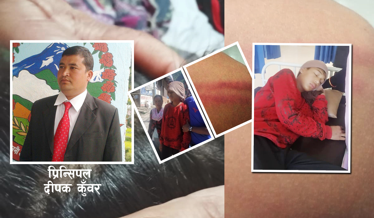 प्रिन्सिपलको कुटाइबाट विद्यार्थी गम्भीर घाइते